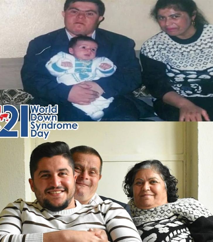 Egy Down-szindrómás apuka története, aki orvost nevelt a fiából