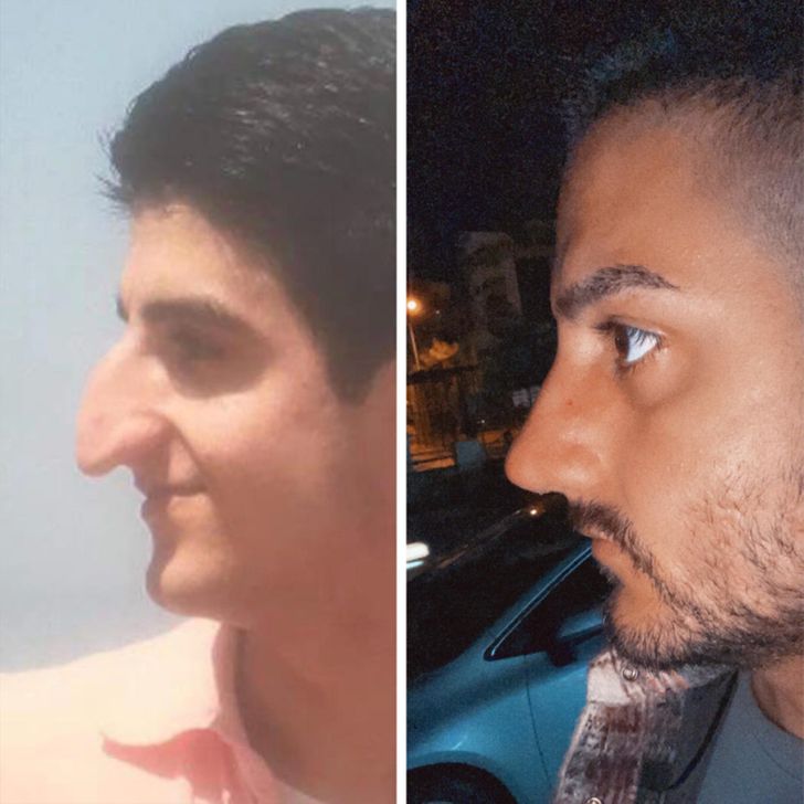 plasztikai műtétek