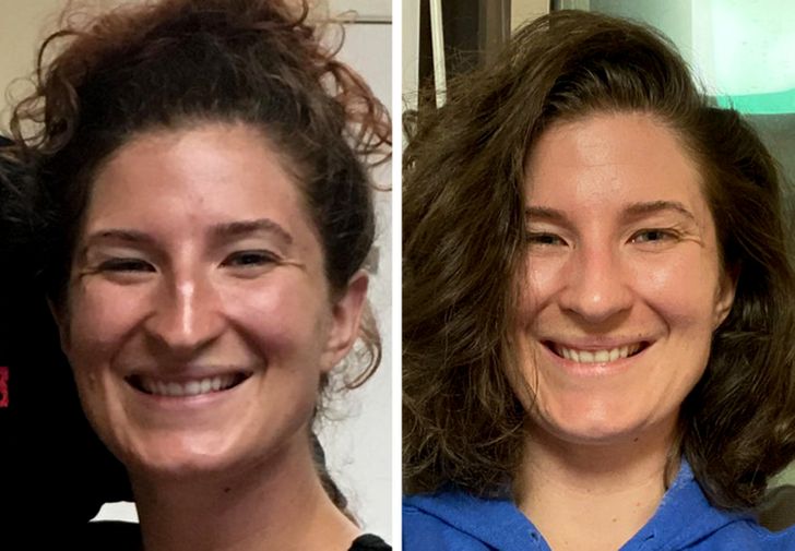 plasztikai műtétek